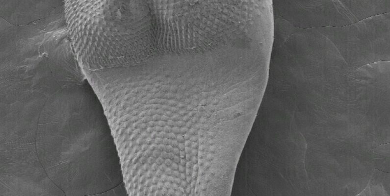 Corynosoma hanna SEM